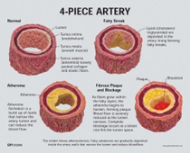 4-Piece Artery Pharmaceutical and Anatomical Model Gifts